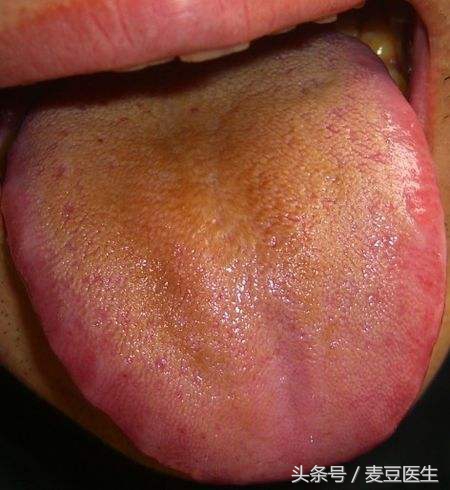 最全中医舌诊图谱来啦!看舌头,知全身!