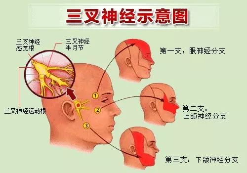 总有人觉得你腰缠万贯,总有人认为你腰缠万贯