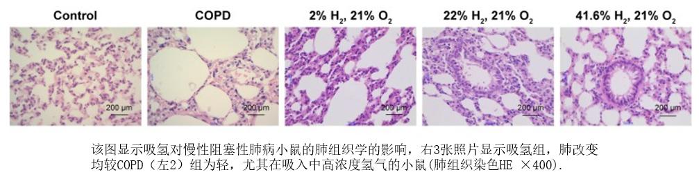 《癌症康复》每日谈｜氢分子与健康的故事（5）：氢气“护”肺