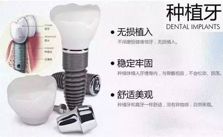 福州种牙补贴什么时候发放,500元福利券领取