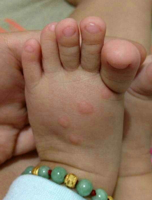 宝妈防蚊妙招,宝妈推荐防蚊必备