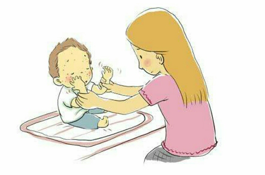 宝妈湿疹反复发作怎么办,母乳宝宝反复湿疹最佳治疗方法