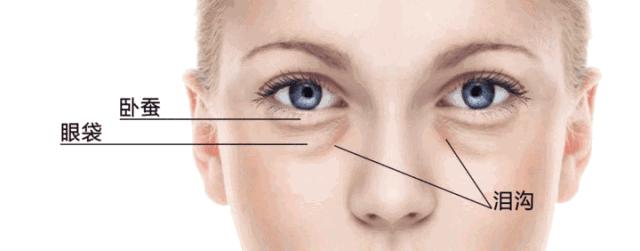 眼袋黑肿是什么样的,为什么眼袋都是黑黑的