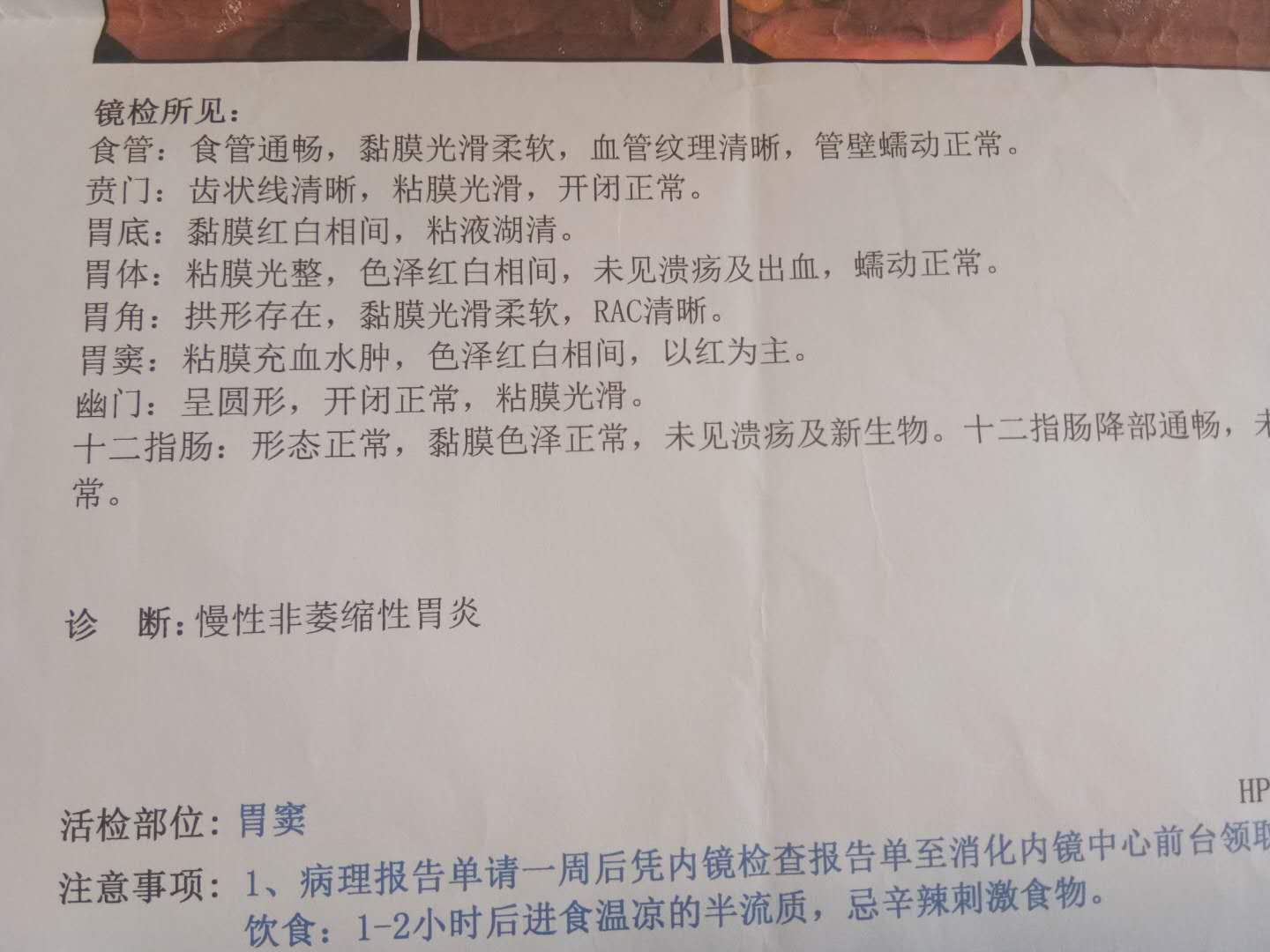 战胜萎缩胃炎,战胜胃病的故事