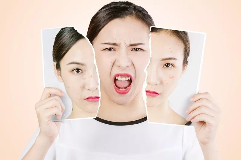 皮肤缺水怎么紧急补救,皮肤缺水过度怎么补救