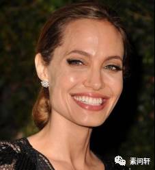 像蚯蚓一样的凸起的纹,像蚯蚓一样黑色的是什么