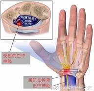 女中老年人手麻是什么原因,中年女人手麻是什么样