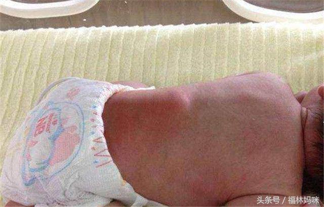 凉席并不凉，孩子睡凉席睡出大问题，这些知识你一定要知道！