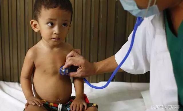 川崎病是皮肤黏膜淋巴结综合征么,川崎病血管炎多久治好