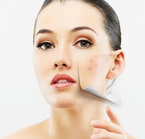 如何快速消除痘印最有效方法,怎么消痘印16个去除痘印的小妙招