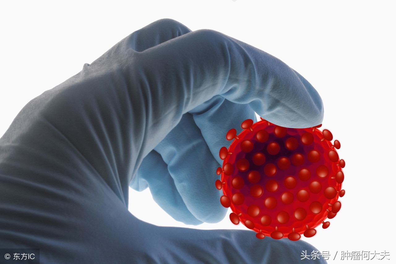 肺癌筛查最准的是用什么方法,肺癌筛查一定做肺穿刺吗