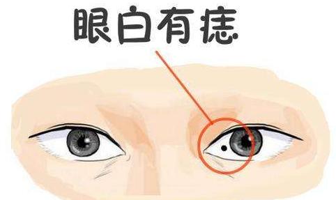 痣相女人脸部痣相图解,女人10处有痣代表富贵痣图解