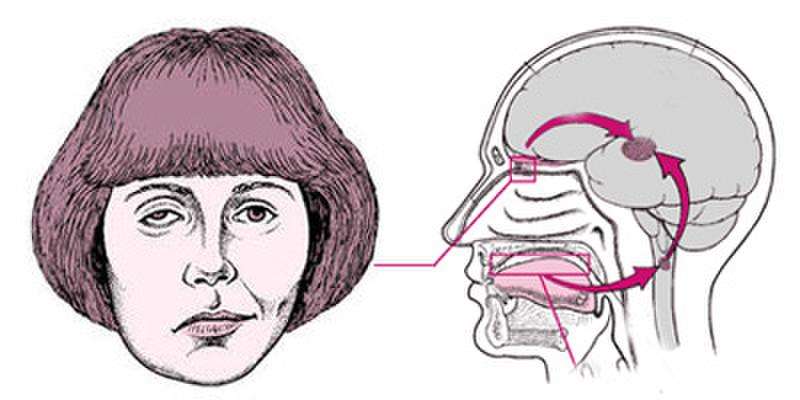 8年面肌痉挛中医能治愈吗,许振南针刀治面肌痉挛