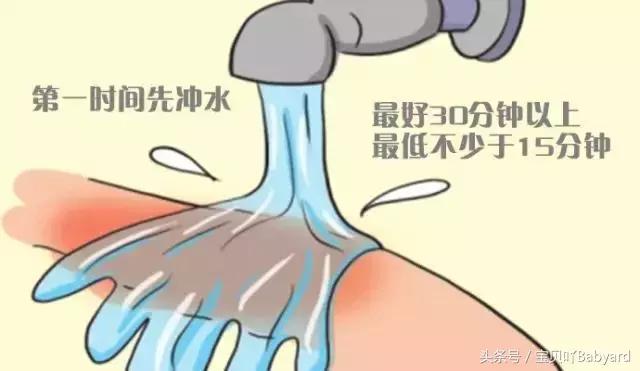 烫伤第一时间自救,烫伤紧急处理视频