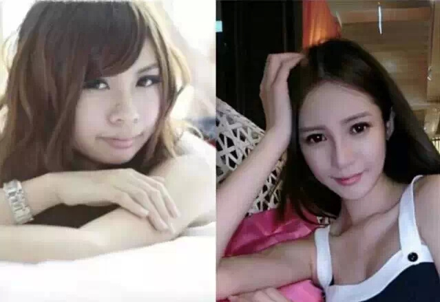 你对整形这件事情怎么看,你对整容的看法英语