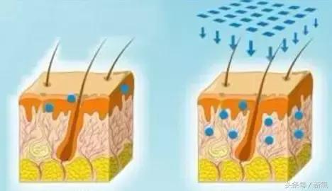治疗痘坑的微针品牌,家用抗皱美白祛斑微针