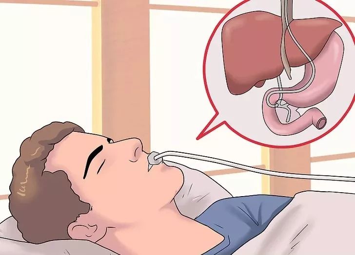 肝癌初期身体的四个症状藏不住,不痛不痒的肝癌是良性还是恶性