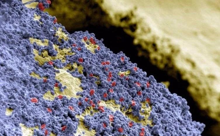 螃蟹和酸奶一起吃中毒,吃了螃蟹喝牛奶会中毒吗