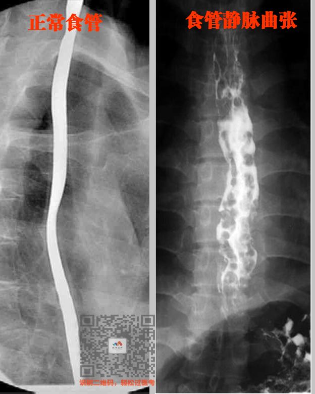 执医技能：X线阅片，全是套路，超简单
