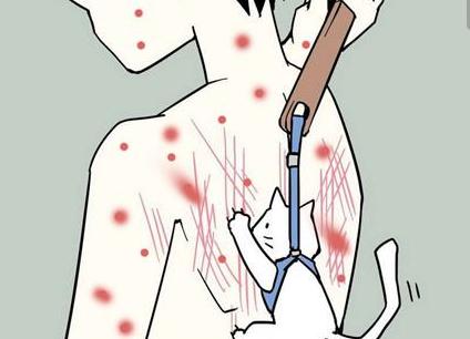 一招解决夏季湿疹问题,容易长湿疹教你3个方法赶走湿疹