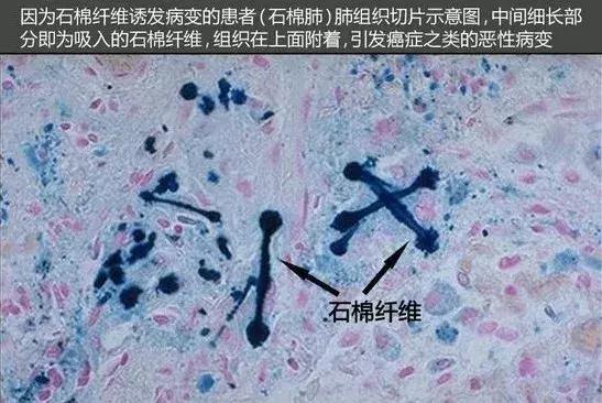 强生痱子粉和爽身粉有什么区别,强生婴儿爽身粉与六神痱子粉