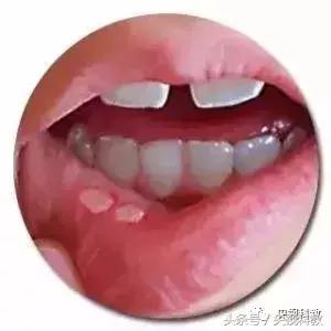 健康之路｜口甜、口咸、口淡的朋友们看过来！