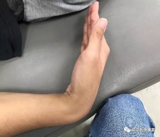 肌腱损伤的指南,长庚肌腱损伤康复训练