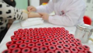 风疹病毒会导致胎儿什么畸形,风疹病毒导致胎儿先天性心脏病吗