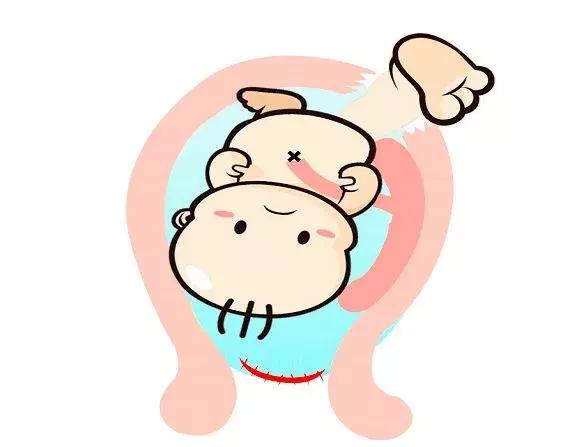 大姨妈不正常，可能是你子宫多了个“小房间”？