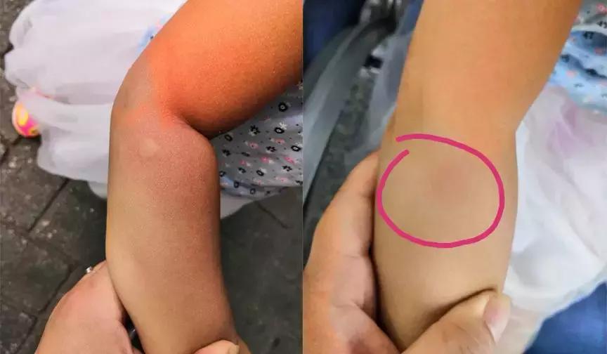 蚊虫叮咬止痒消肿驱蚊膏,止痒膏驱蚊止痒