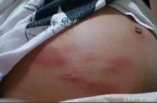 孕期有点不舒服就去检查,孕期有不舒服的应该看什么科室