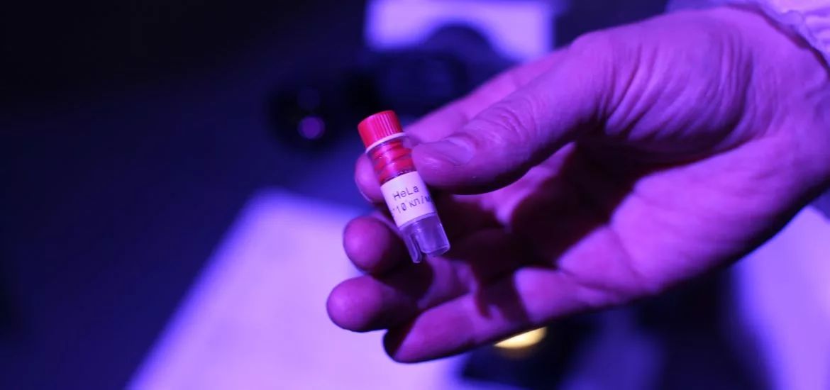 这些细胞害死了主人之后，又在实验室里繁殖了18000代