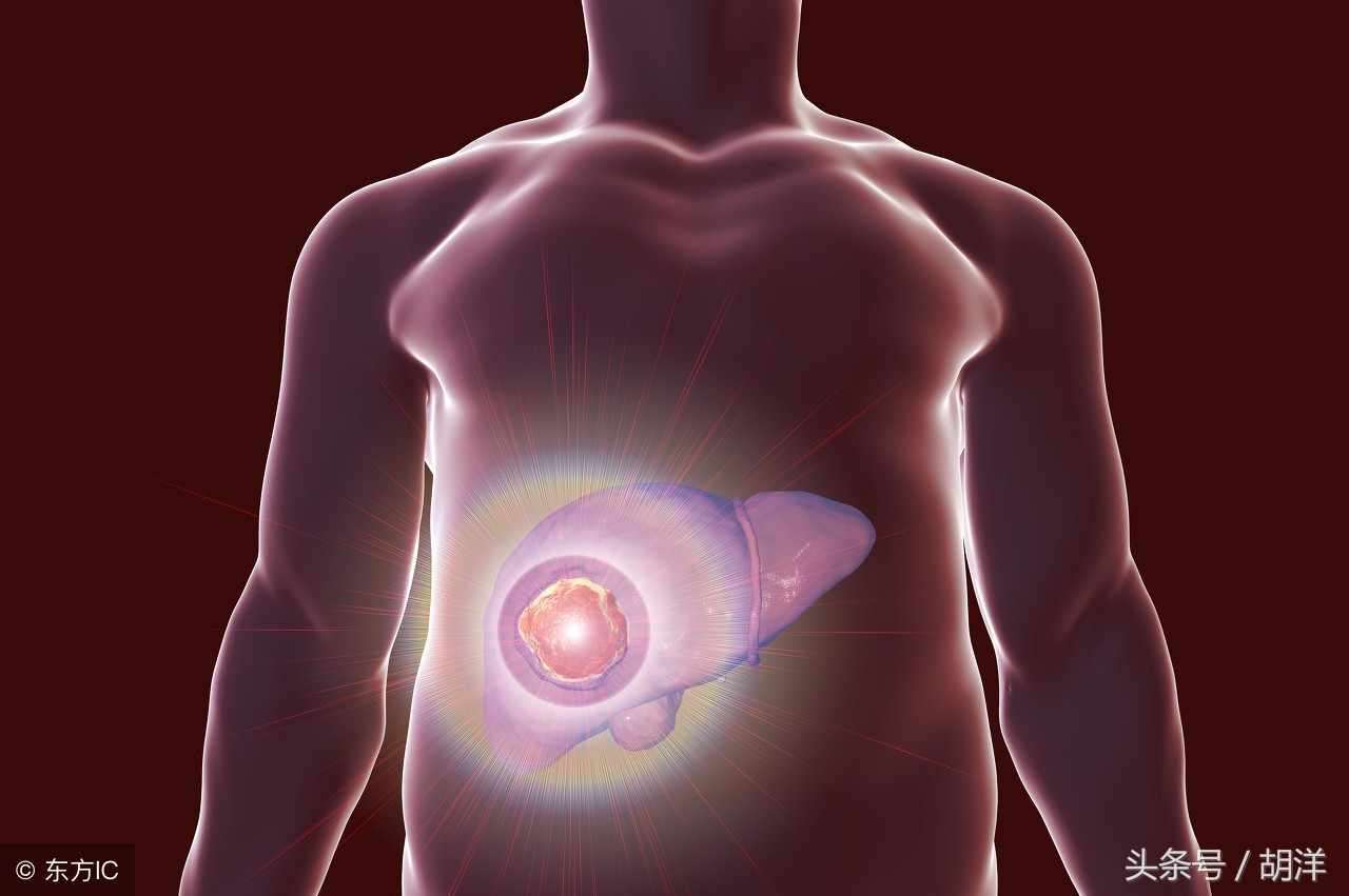 小苏打可以抑制癌症的作用,小苏打水治癌症可靠吗