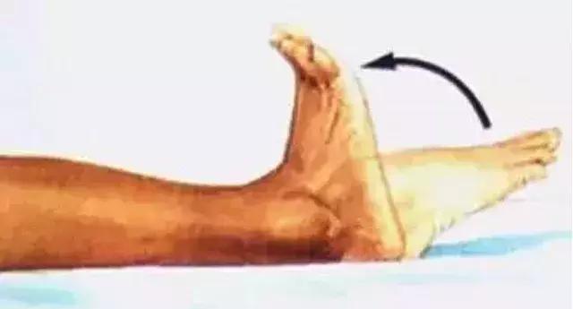 手术后病人应该怎么躺,手术后怎么躺着舒服