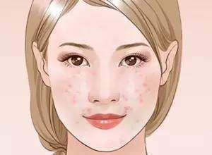 让毛孔变小用什么药,30几岁的皮肤毛孔粗能变小吗