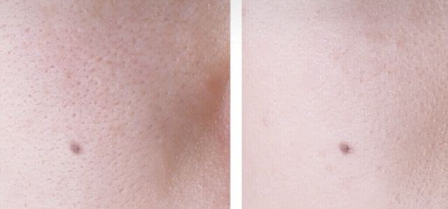 乐敦cc维c美白淡斑霜好用吗,乐敦cc祛黑色素效果怎么样