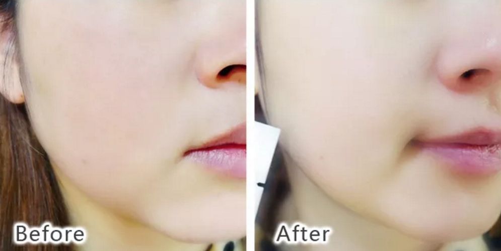 冰岛补水美白面膜,波兰面膜