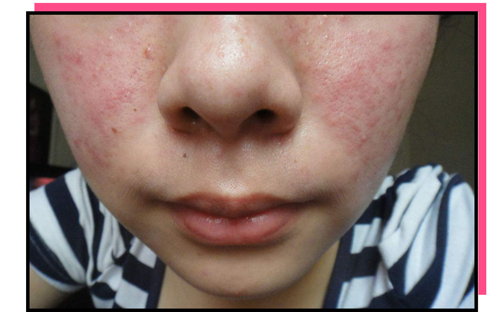 抖音上销量破亿的日本药妆，真那么好用吗？！