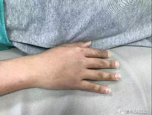 世界杯球员受伤,世界杯运动员损伤情况