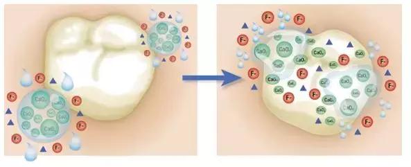 乳牙蛀了不疼,乳牙蛀了不用管