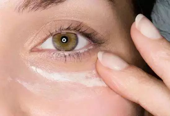 擦眼霜眼角长了脂肪粒,眼睛长脂肪粒和眼霜有关系吗