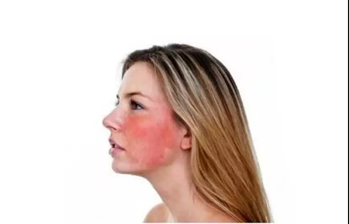 「杏仁医生」激素药膏烂脸、毁皮肤？皮肤科医生：九成人都想错了