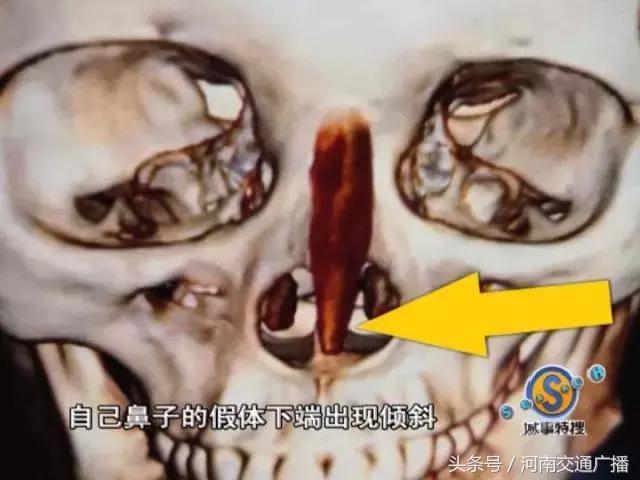 女子整容失败医院说没问题,女子整容失败医院讨说法被阻拦