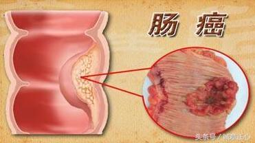 妹子“放臭气”惹非议，到医院检查却令所有人都傻眼了！