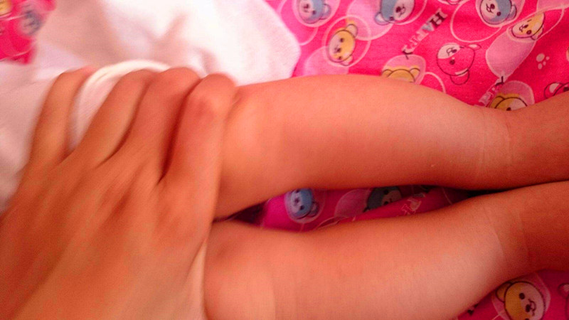 为什么宝宝会有o型腿,为什么宝宝会是o型腿