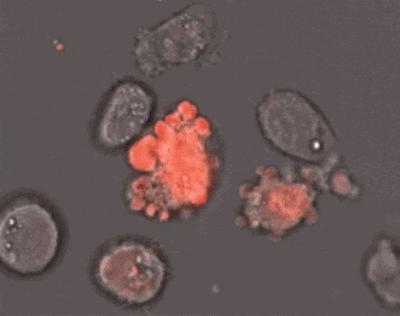 细胞免疫治疗肿瘤什么时间推行的,细胞免疫治疗学