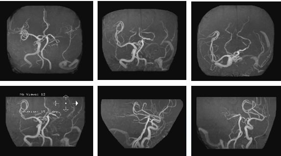 心血管内科急救流程,急诊静脉用药方法