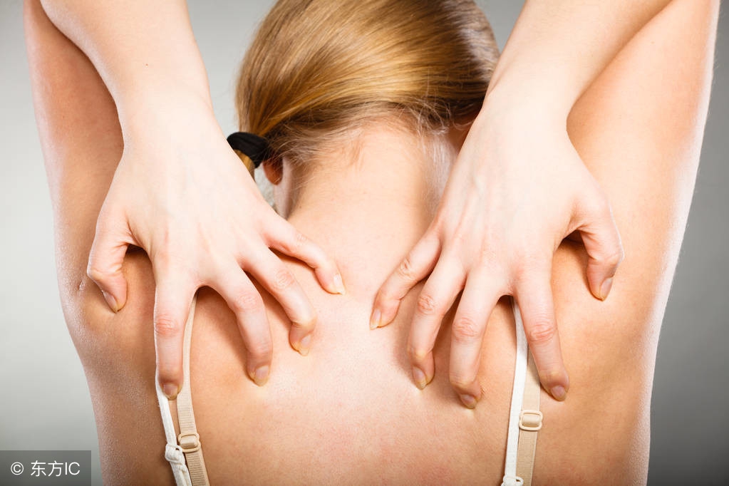 对待*麻疹荨**一定要避免*麻疹荨**的治疗误区