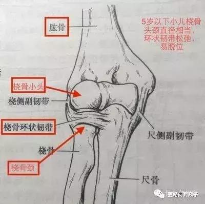 比较少见的脱位,小儿肘关节脱位最常见的脱位分类