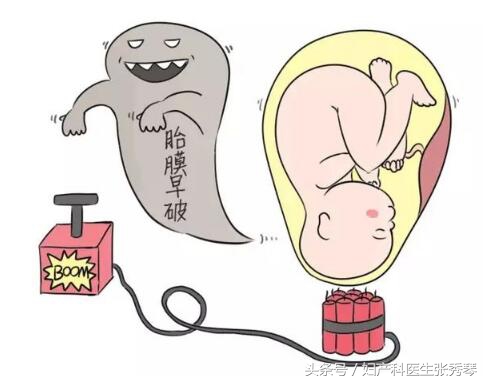 发生胎膜早破应该怎么办？